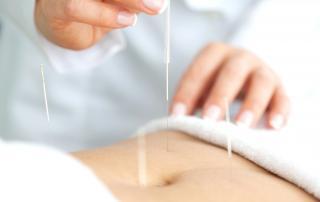 Acupuncture and Fertility